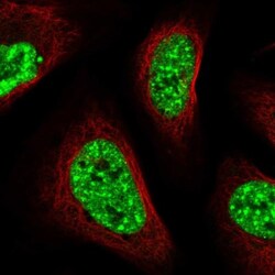 CIP29 Antibody, Novus Biologicals 0.1mL; Unlabeled:Antibodies, Polyclonal