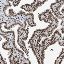 CIP29 Antibody, Novus Biologicals 0.1mL; Unlabeled:Antibodies, Polyclonal