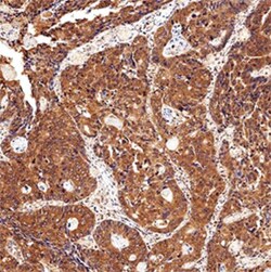 CIP2A Antibody (2G10), Novus Biologicals 0.025mL; Unlabeled:Antibodies,