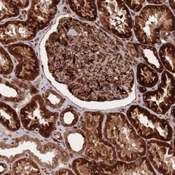 CISH/CIS-1 Antibody, Novus Biologicals 0.1mL; Unlabeled:Antibodies, Polyclonal