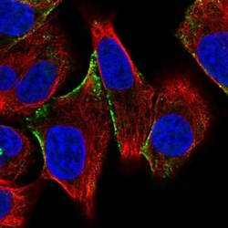 CITED4 Antibody, Novus Biologicals 0.1mL; Unlabeled:Antibodies, Polyclonal