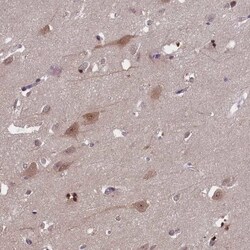 CKAP1 Antibody, Novus Biologicals:Antibodies:Primary Antibodies