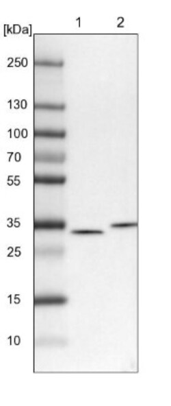 CKAP1 Antibody, Novus Biologicals:Antibodies:Primary Antibodies