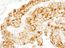 CKAP4/p63 Antibody, Novus Biologicals 0.1mL; Unlabeled:Antibodies, Polyclonal