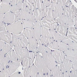 CKAP4/p63 Antibody, Novus Biologicals 0.1mL; Unlabeled:Antibodies, Polyclonal