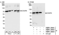 CKAP4/p63 Antibody, Novus Biologicals 0.1mL; Unlabeled:Antibodies, Polyclonal