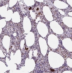 CLP1/HEAB Antibody, Novus Biologicals 0.1mL; Unlabeled:Antibodies, Polyclonal