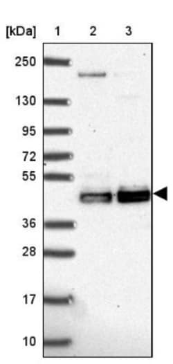 CLP1/HEAB Antibody, Novus Biologicals 0.1mL; Unlabeled:Antibodies, Polyclonal
