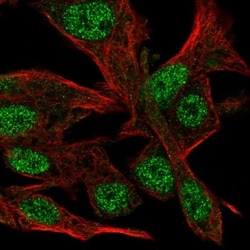CLASRP Antibody, Novus Biologicals 0.1mL; Unlabeled:Antibodies, Polyclonal