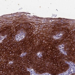 anti-CLCA2, Polyclonal, Novus Biologicals 0.1mL; Unlabeled:Antibodies,
