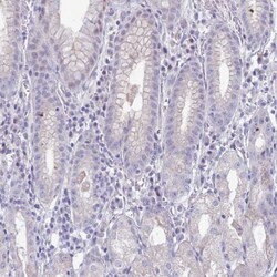 anti-CLCA2, Polyclonal, Novus Biologicals 0.1mL; Unlabeled:Antibodies,