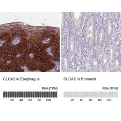 anti-CLCA2, Polyclonal, Novus Biologicals 0.1mL; Unlabeled:Antibodies,