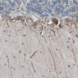 CLCC1 Antibody, Novus Biologicals 25 &mu;L; Unlabeled:Antibodies, Polyclonal