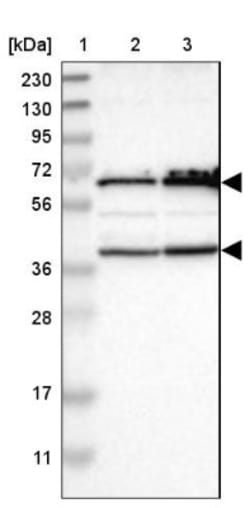 CLCC1 Antibody, Novus Biologicals 0.1mL; Unlabeled:Antibodies, Polyclonal