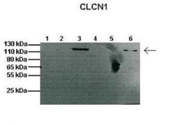 CLCN1 Antibody, Novus Biologicals 100&mu;L; Unlabeled:Antibodies, Polyclonal