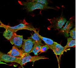 CLCN3 Antibody (S258-5), Novus Biologicals:Antibodies:Primary Antibodies