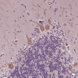 CLCN4 Antibody, Novus Biologicals 0.1mL; Unlabeled:Antibodies, Polyclonal