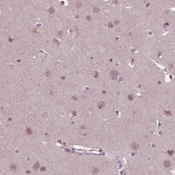 CLCN4 Antibody, Novus Biologicals 0.1mL; Unlabeled:Antibodies, Polyclonal