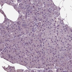 CLCN4 Antibody, Novus Biologicals 0.1mL; Unlabeled:Antibodies, Polyclonal