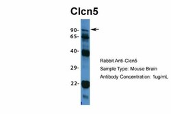 CLCN5 Antibody, Novus Biologicals:Antibodies:Primary Antibodies