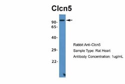 CLCN5 Antibody, Novus Biologicals:Antibodies:Primary Antibodies