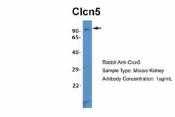 CLCN5 Antibody, Novus Biologicals:Antibodies:Primary Antibodies