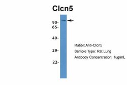 CLCN5 Antibody, Novus Biologicals:Antibodies:Primary Antibodies