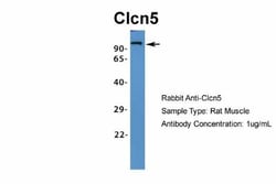 CLCN5 Antibody, Novus Biologicals:Antibodies:Primary Antibodies