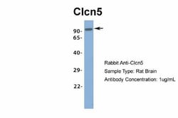 CLCN5 Antibody, Novus Biologicals:Antibodies:Primary Antibodies