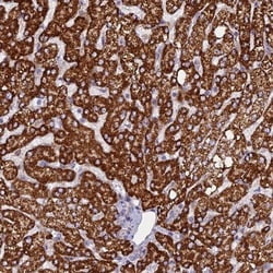 CLCN7 Antibody, Novus Biologicals 25 &mu;L, Unconjugated:Antibodies, Polyclonal