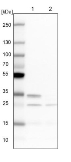 CLE7 homolog Antibody, Novus Biologicals 0.1mL; Unlabeled:Antibodies, Polyclonal