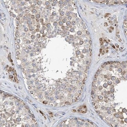 CLEC16A Antibody, Novus Biologicals 0.1mL; Unlabeled:Antibodies, Polyclonal