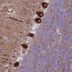 CLEC2L Antibody, Novus Biologicals 25 &mu;L, Unlabeled:Antibodies, Polyclonal