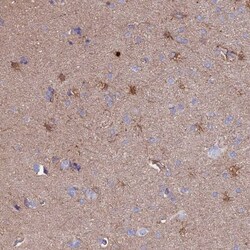 CLEC2L Antibody, Novus Biologicals 25 &mu;L, Unlabeled:Antibodies, Polyclonal