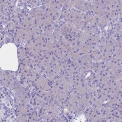 CLEC2L Antibody, Novus Biologicals 25 &mu;L, Unlabeled:Antibodies, Polyclonal