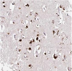 CLEC3A Antibody, Novus Biologicals:Antibodies:Primary Antibodies