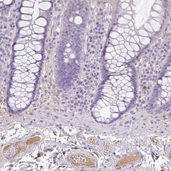 CLEC3B/Tetranectin Antibody, Novus Biologicals 0.1mL; Unlabeled:Antibodies,