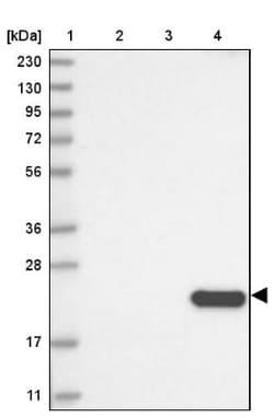 CLEC3B/Tetranectin Antibody, Novus Biologicals 0.1mL; Unlabeled:Antibodies,