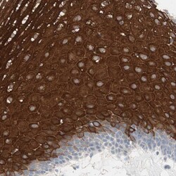 CLEC4D/CLECSF8 Antibody, Novus Biologicals 25 &mu;L | Buy Online | Novus Biologicals | Fisher Scientific