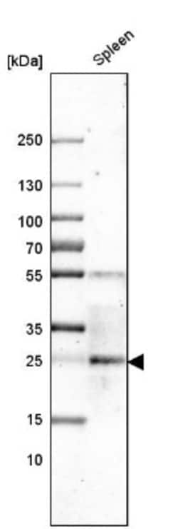 CLEC4E Antibody, Novus Biologicals 25 &mu;L, Unlabeled:Antibodies, Polyclonal