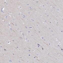 CLIC3 Antibody, Novus Biologicals:Antibodies:Primary Antibodies