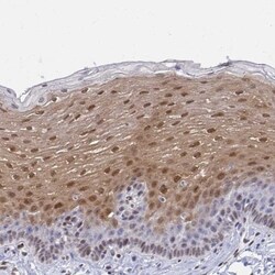 CLIC3 Antibody, Novus Biologicals:Antibodies:Primary Antibodies