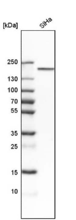 CLIP170 Antibody, Novus Biologicals 25 &mu;L; Unlabeled:Antibodies, Polyclonal