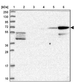 CLIP4 Antibody, Novus Biologicals 25 &mu;L, Unconjugated:Antibodies, Polyclonal