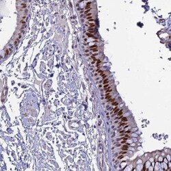 CLK4 Antibody, Novus Biologicals 25 &mu;L; Unlabeled:Antibodies, Polyclonal