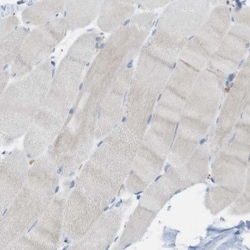 CLMN Antibody, Novus Biologicals:Antibodies:Primary Antibodies