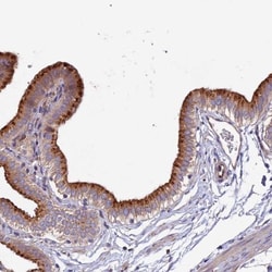 CLN5 Antibody, Novus Biologicals 0.1mL; Unlabeled:Antibodies, Polyclonal