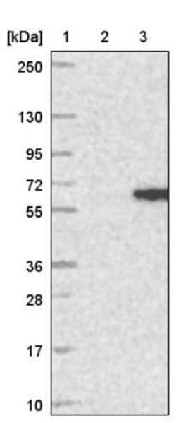 CLN5 Antibody, Novus Biologicals 0.1mL; Unlabeled:Antibodies, Polyclonal