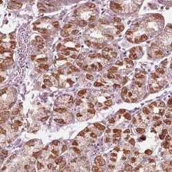 CLN6 Antibody, Novus Biologicals 0.1mL; Unlabeled:Antibodies, Polyclonal