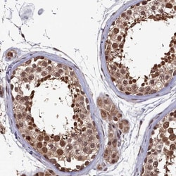 CLPX Antibody, Novus Biologicals 0.1mL; Unlabeled:Antibodies, Polyclonal